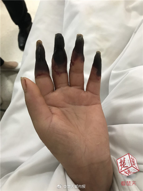 【吃瓜网站传送门】穿上睡觉会比较舒服